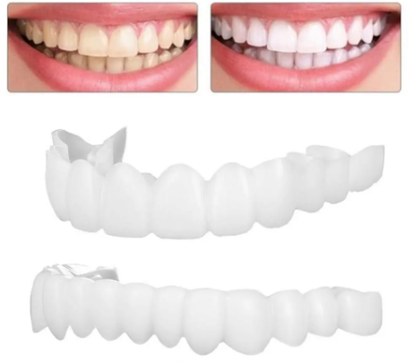 CARILLAS DENTALES SUPERIOR E INFERIOR